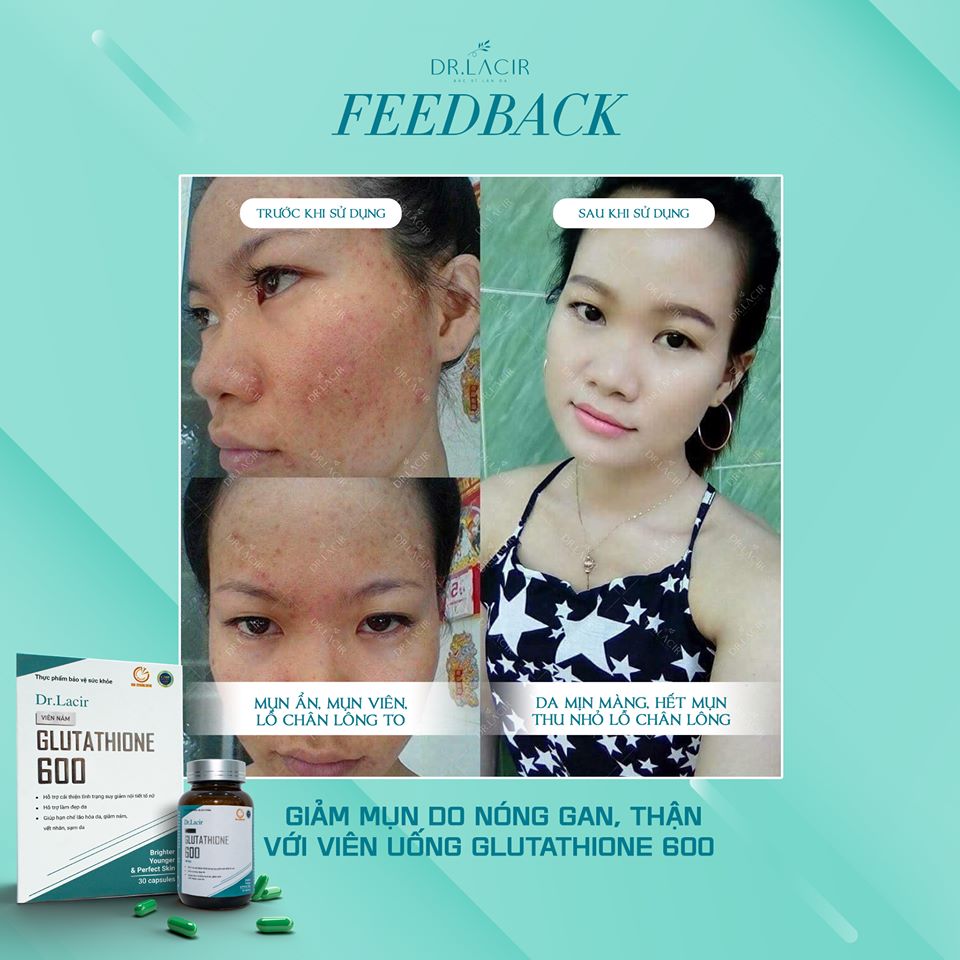 Viên uống Glutathione 600