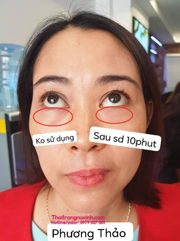 Kem mắt laluxxy Dr_Lacir -LKD17